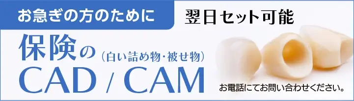 お急ぎの方のために CAD/CAM お電話にてお問い合わせください