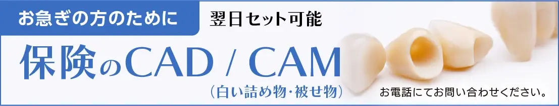 お急ぎの方のために CAD/CAM お電話にてお問い合わせください