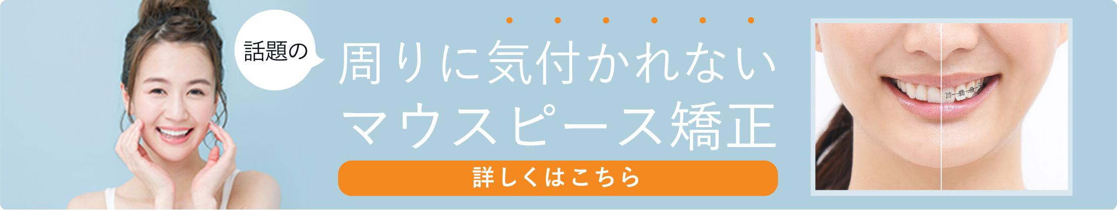 周りに気付かれないマウスピース矯正